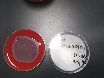 Escherichia coli-BNCC