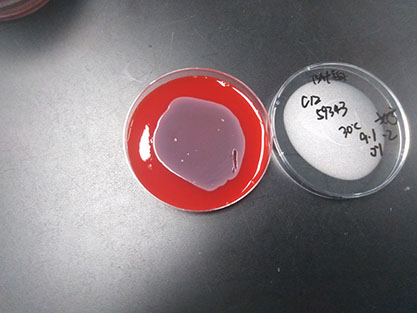 Escherichia coli-BNCC