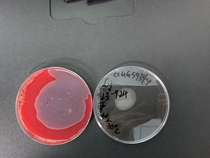 Escherichia coli-BNCC