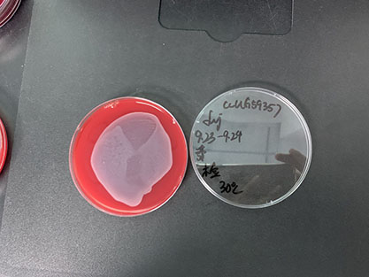 Escherichia coli-BNCC