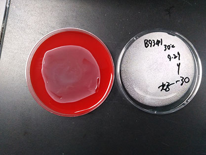 Escherichia coli-BNCC