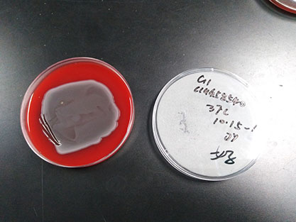 Escherichia coli-BNCC