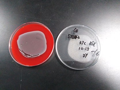 Escherichia coli-BNCC