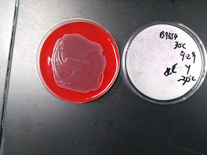 Escherichia coli-BNCC