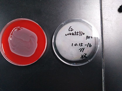 Escherichia coli-BNCC