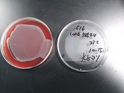 Escherichia coli-BNCC