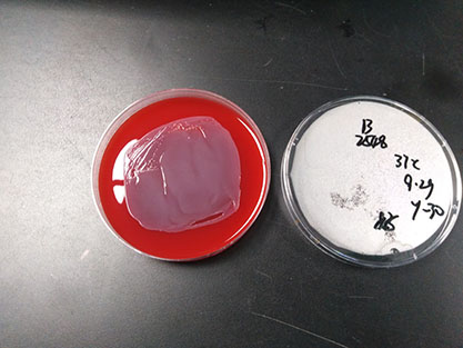 Chryseobacterium pallidum-BNCC