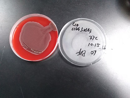 Escherichia coli-BNCC