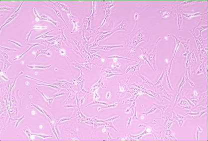 Human Schwann cells (neurofibromatosis type 1)-BNCC