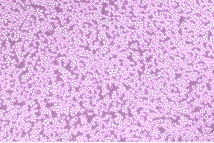 Human chronic myeloid leukemia cells-BNCC