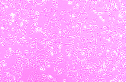 Mouse bladder cancer cells-BNCC