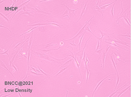 Normal human skin fibroblasts-BNCC