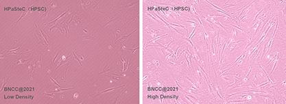 human pancreatic stellate cells-BNCC