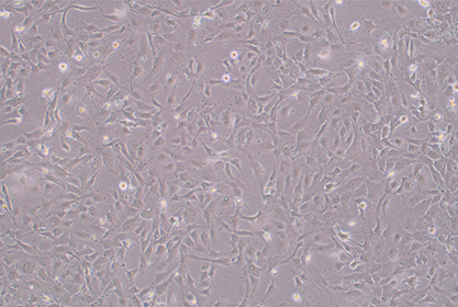 Human retinal microvascular endothelial cells-BNCC