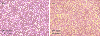 Human Erythrocyte Leukemia Lymphocytes-BNCC