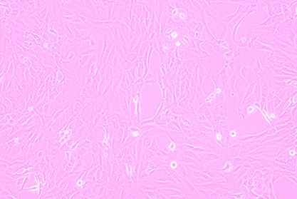 Human bronchial epithelial cells-BNCC