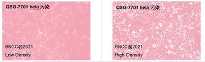 Human hepatocytes-BNCC