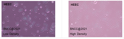 Human normal esophageal epithelial cells-BNCC