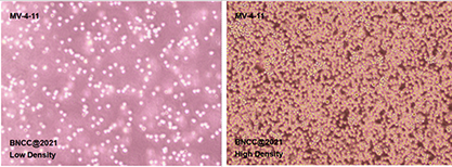 Human myeloid monocytic leukemia cells-BNCC
