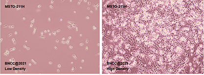 Human lung cancer cell line-BNCC