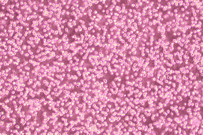 Human hisocytic lymphoma cells-BNCC