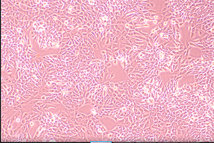 Highly metastatic human liver cancer cells-BNCC