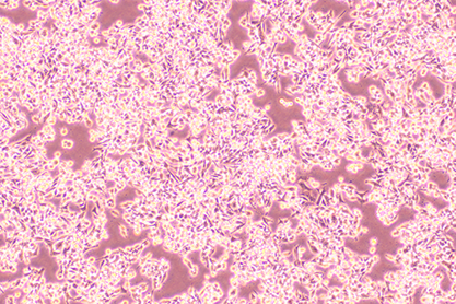 Human colon adenocarcinoma cells-BNCC