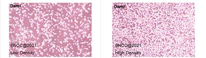 Human megakaryocytic leukemia cell-BNCC