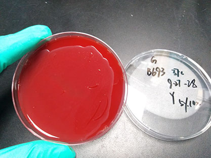 Neisseria meningitidis A-BNCC