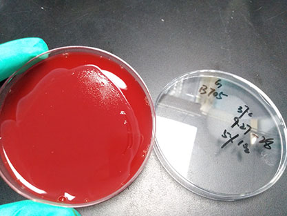 Neisseria meningitidis B-BNCC