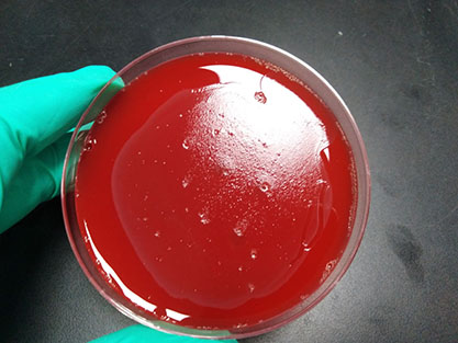 Neisseria meningitidis C-BNCC