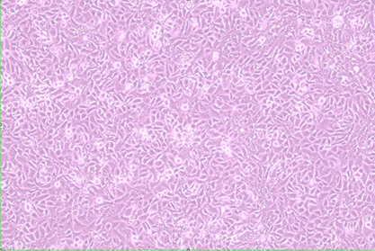 Human laryngeal cancer cells-BNCC