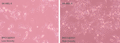 Human skin melanoma cells-BNCC