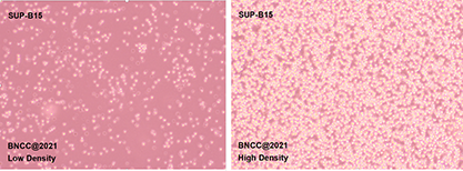 Human bone marrow acute lymphoblastic leukemia cells-BNCC