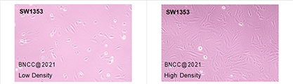 Human chondrosarcoma cells-BNCC