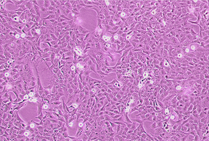 Human chorionic trophoblast cell-BNCC