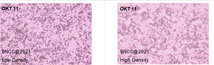 Hybridoma cells (anti-CD2)-BNCC