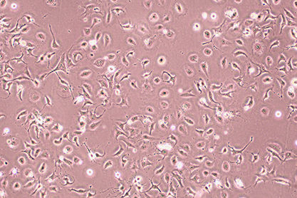 Human nasopharyngeal epithelial cells-BNCC