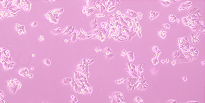 Human esophageal cancer cells-BNCC