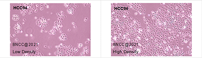 Human uterine squamous cell carcinoma (highly differentiated)-BNCC