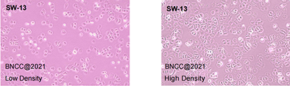 Human adrenocortical small cell carcinoma-BNCC