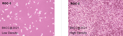Mouse retinal ganglion cells-BNCC