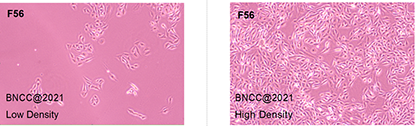 Human adenocarcinoma cells (mouse hybridoma)-BNCC