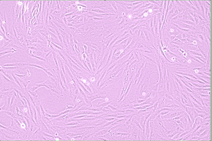 Human neuroblastoma cells-BNCC