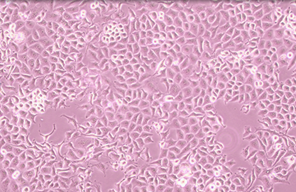 Human liver cancer cells-BNCC