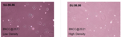 Human pancreatic duct cancer cells-BNCC