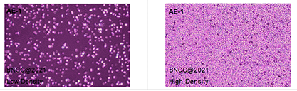Hybridoma cell anti-AChE-BNCC