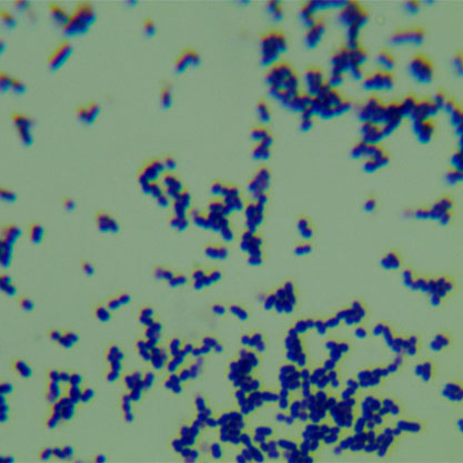 Streptococcus salivarius-BNCC
