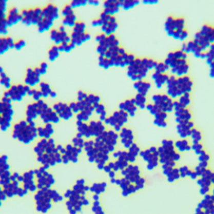 Micrococcus lysodeikticus-BNCC