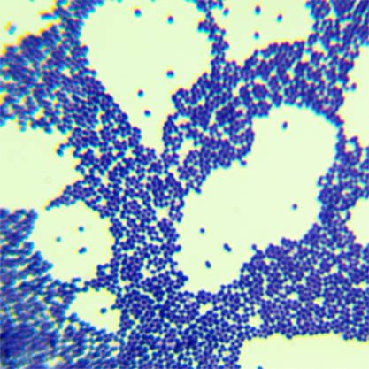 Streptococcus bovis-BNCC